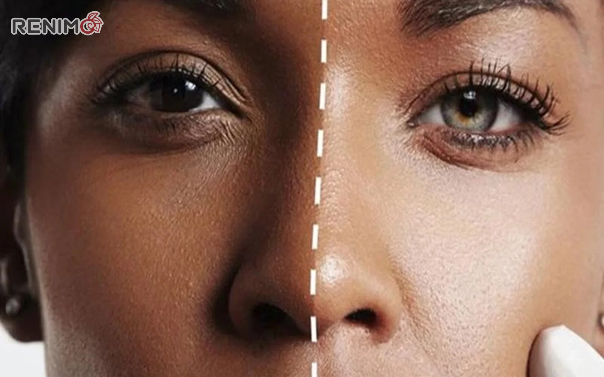 چه عواملی باعث تغییر رنگ پوست می‌شوند؟