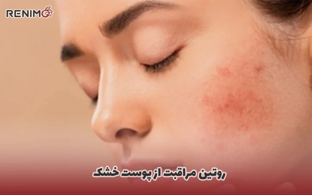 روتین مراقبت از پوست خشک