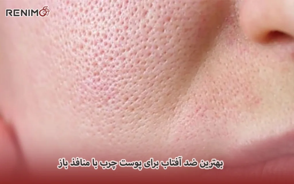 بهترین ضد آفتاب برای پوست چرب با منافذ باز