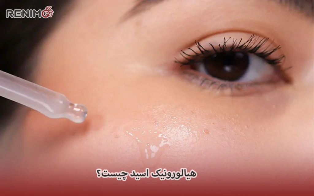 هیالورونیک اسید چیست؟