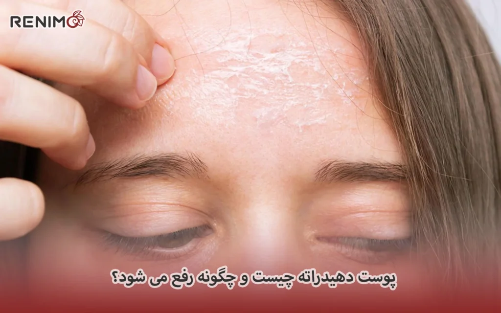 پوست دهیدراته چیست و چگونه رفع می شود؟