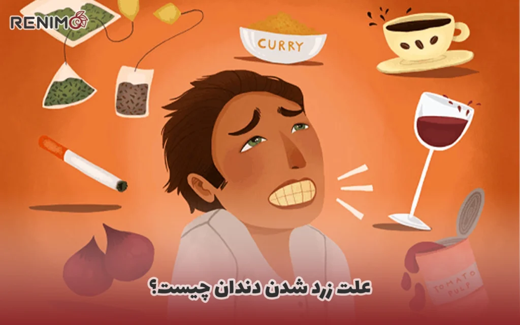 علت زرد شدن دندان چیست؟