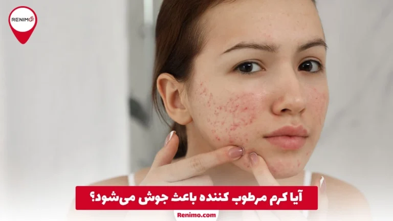 آیا کرم مرطوب کننده باعث جوش می‌شود؟